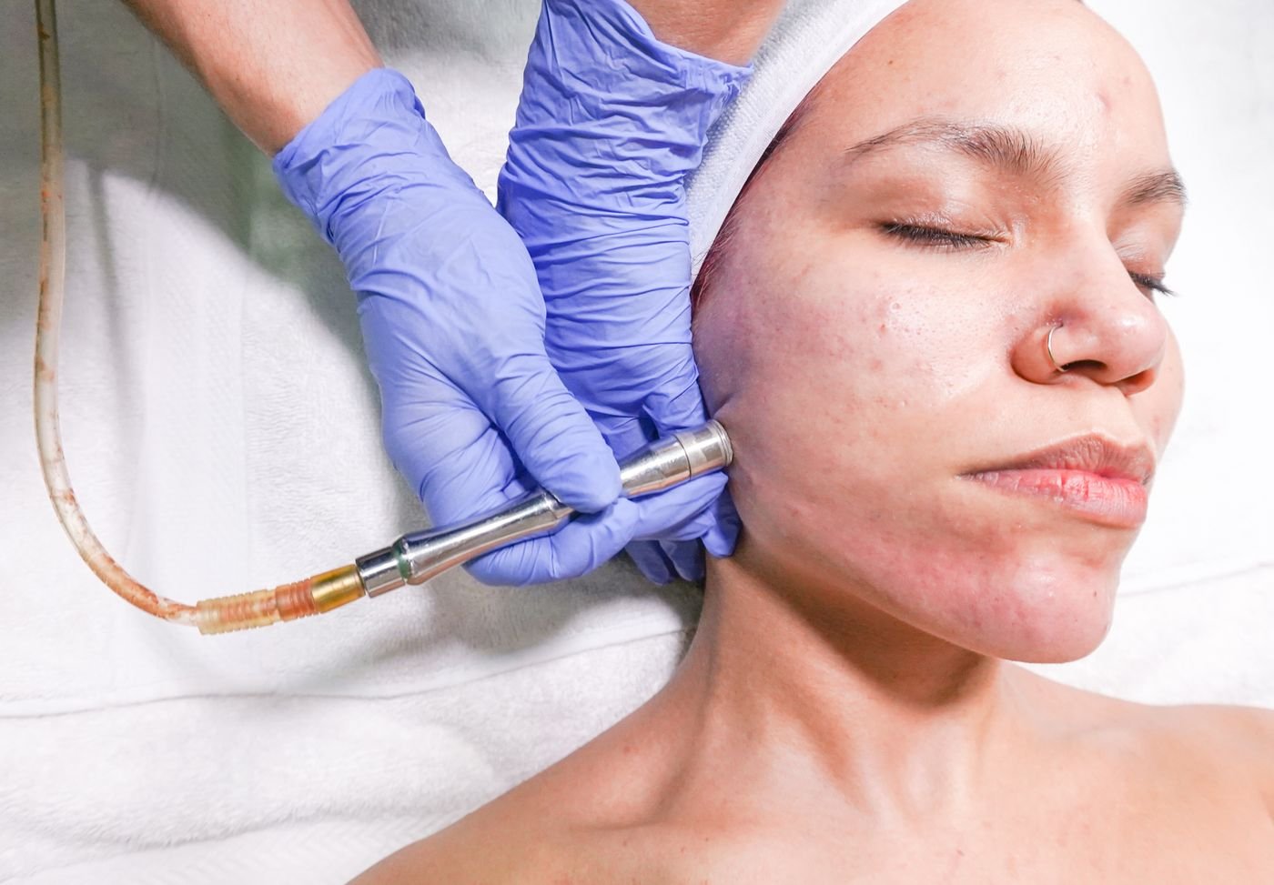 Stock photo of a client receiving a skin treatment